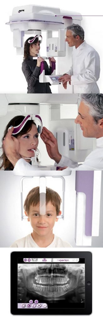 Hyperion X7 X-Ray Machine